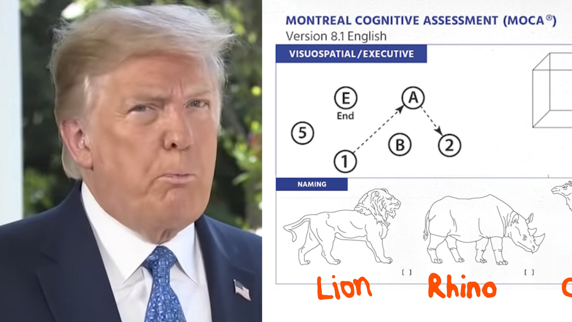 What Is The Cognitive Test Trump Keeps Bragging About 